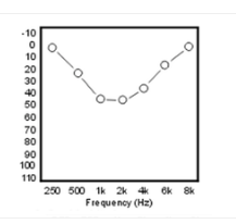cookie bite on audiogram